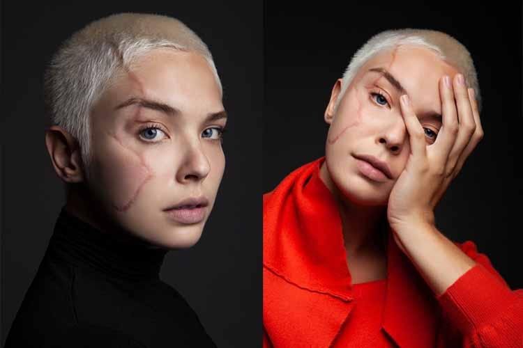 Giulia Dias empodera mulheres com cicatrizes e estrela primeira campanha de beleza!