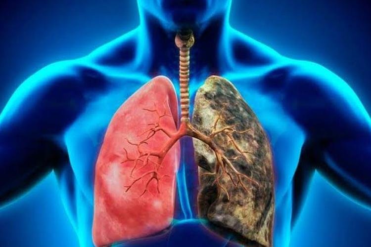 Instituto Oncoguia premiará melhor matéria jornalística sobre câncer de pulmão