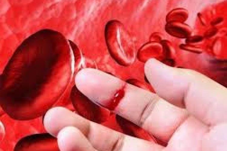 SUS disponibiliza nova opção de tratamento para hemofilia A