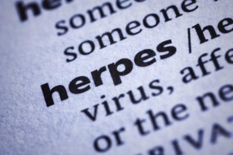 Herpes sem crise, mas com prevenção e tratamento