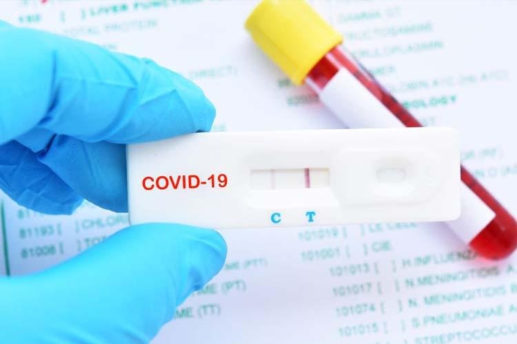 Programa de Combate a Epidemias recebe até amanhã (30) propostas de pesquisadores