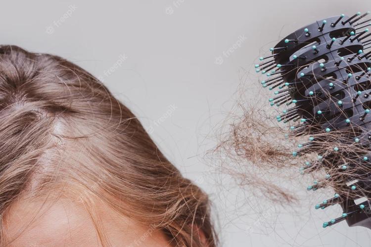 Por que estamos perdendo cabelo? Especialista explica as possíveis causas