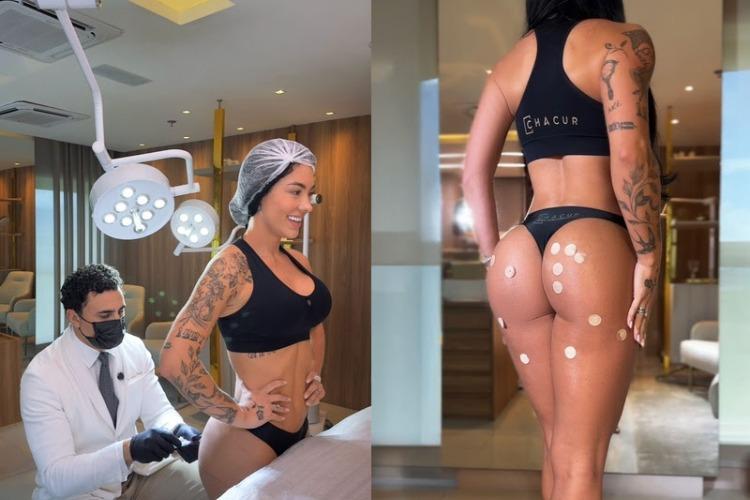 Rayane Figliuzzi diz que médico é o “segundo dono” de seu bumbum, após Belo, e comenta cuidados estéticos