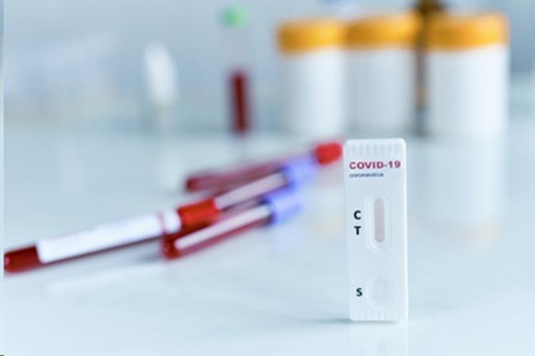 MPF denuncia ex-prefeita de Oiapoque (AP) e mais três pessoas por desvio de testes para covid-19 e medicamentos