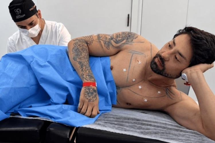 Após "cutox" de Rico Melquiades, médico explica outros lugares inusitados onde o botox pode ser aplicado