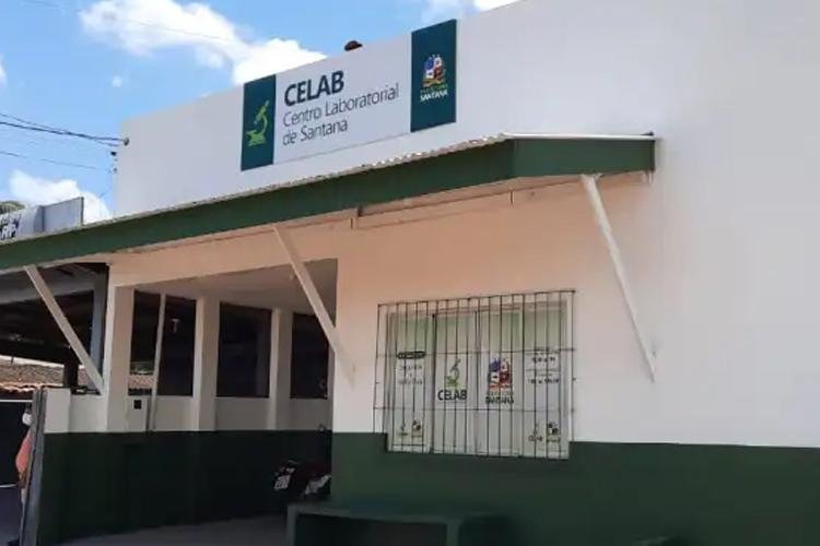 Centro Laboratorial de Santana oferta mais de 70 exames; confira horário de atendimento