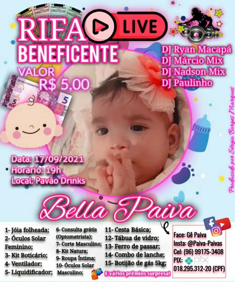 Rifa Live beneficente busca ajudar criança com Microcrania