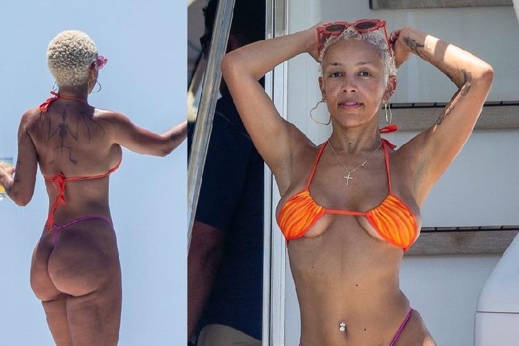 Doja Cat suspeita de lipedema e levanta dúvida comum entre mulheres: é celulite ou outra condição?