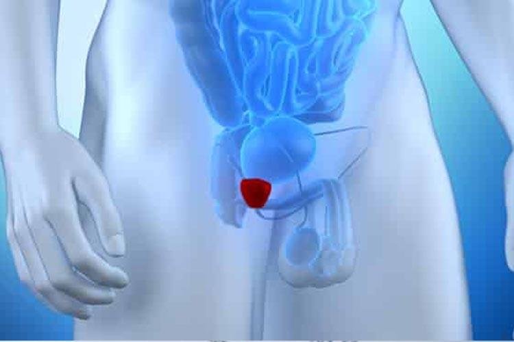 Teste genético ajuda na prevenção do câncer de próstata, orienta médico da Unifesp