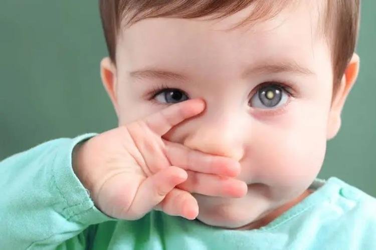 Governo do Amapá alerta para sinais do retinoblastoma e importância do diagnóstico precoce