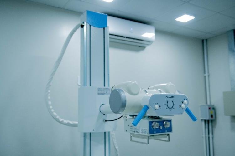 Governo do Amapá moderniza saúde com novo aparelho de Raio-X no Hospital de Emergências