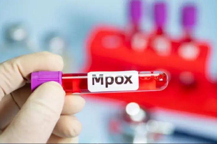 Governo do Amapá esclarece: não há casos de Mpox registrados no estado em 2025