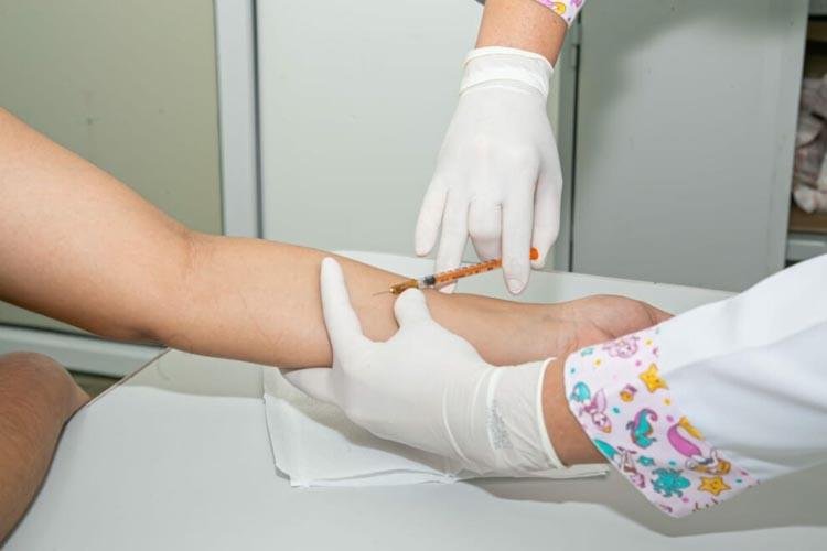 UBS Marcelo Cândia e Congós realizam exames para diagnóstico da Tuberculose Latente