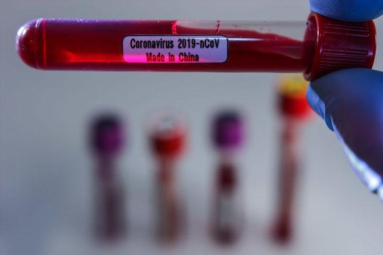 Coronavírus: Brasil tem 1.128 casos confirmados e 18 mortes, diz Saúde