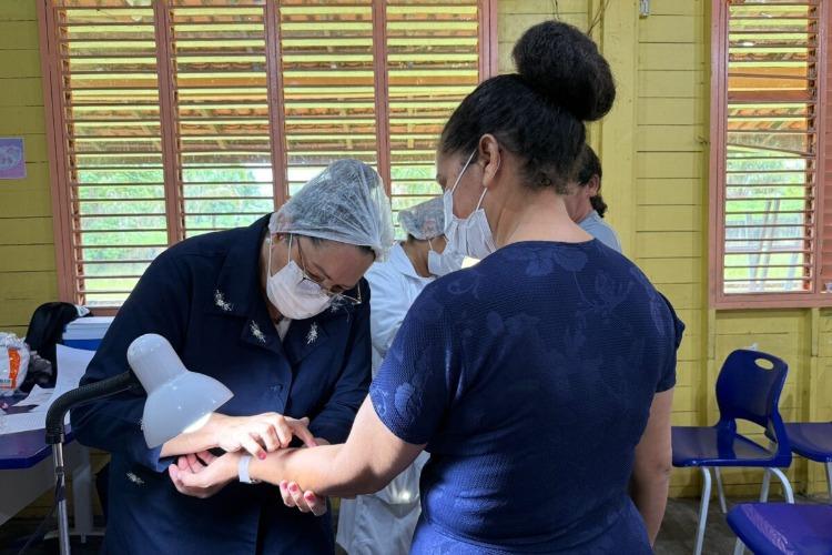 Após 6 casos confirmados de infecção latente da tuberculose, Prefeitura de Macapá encaminha moradores da comunidade de Tracajatuba 1 para atendimento no Papaléo Paes