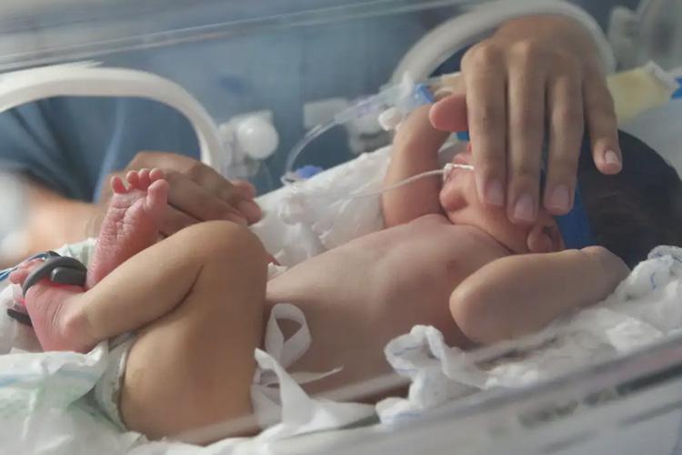 MAM Baby destaca prematuridade com neonatologista: Informações sobre causas e fatores de risco