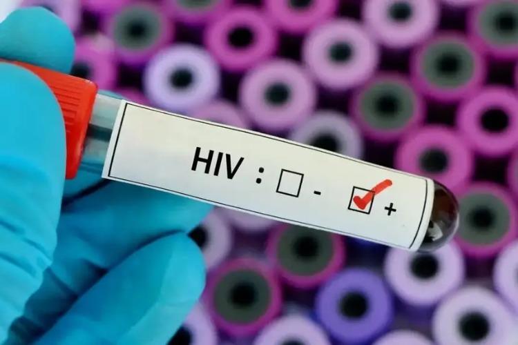 Amapá fortalece políticas de cuidado e prevenção ao HIV/Aids