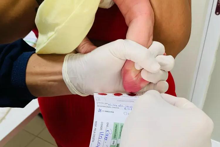Hospital da Mulher Mãe Luzia realiza cerca de 350 testes do pezinho por mês em Macapá; saiba como é realizado