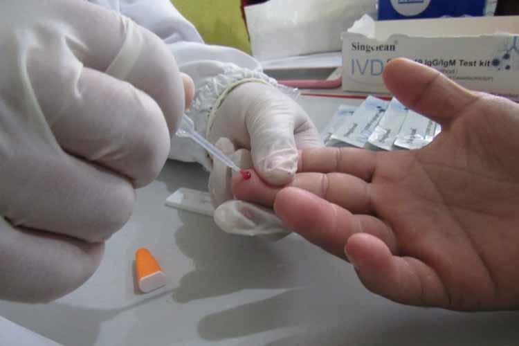 OFERTA DE TESTES RÁPIDOS SE CONCENTRARÁ NAS UNIDADES QUE SÃO REFERÊNCIA NO ATENDIMENTO À COVID-19