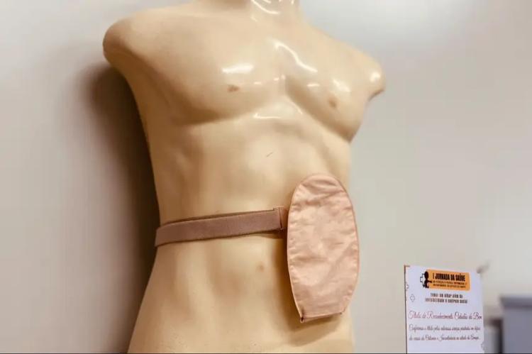 Governo do Amapá garante assistência especializada e tecnologia de ponta a pacientes ostomizados no Creap