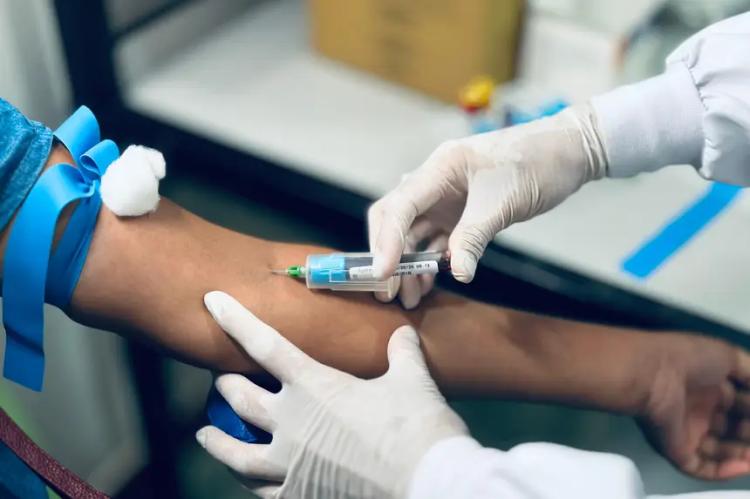 Governo do Amapá implanta exame de agregação plaquetária no Hemoap